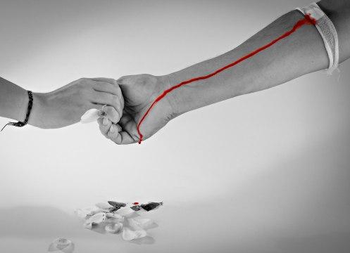 黑白画面滴血的胳膊和另一只手握在一起