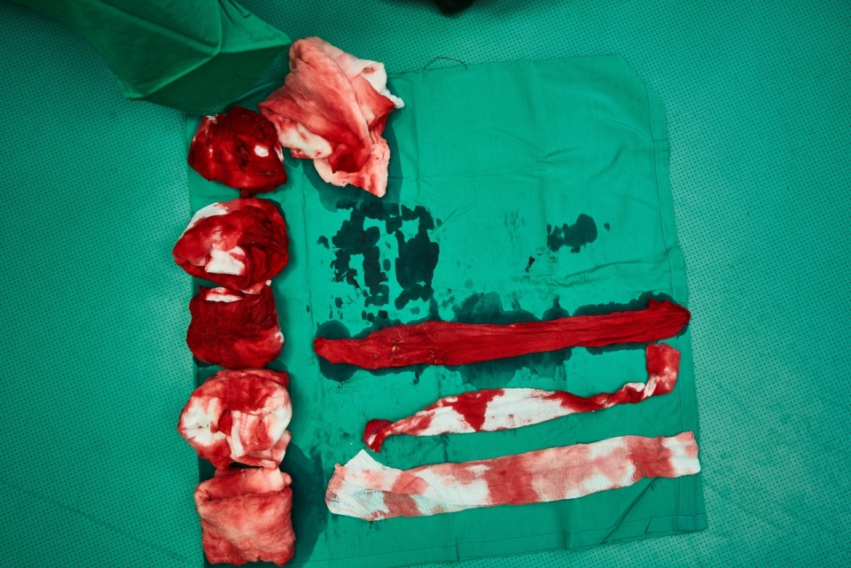 微距摄影_手术布排列的沾满血的纱布